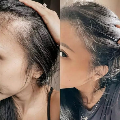 Botanical Growth Serum — the art of hair regeneration, powered by nature and backed by science