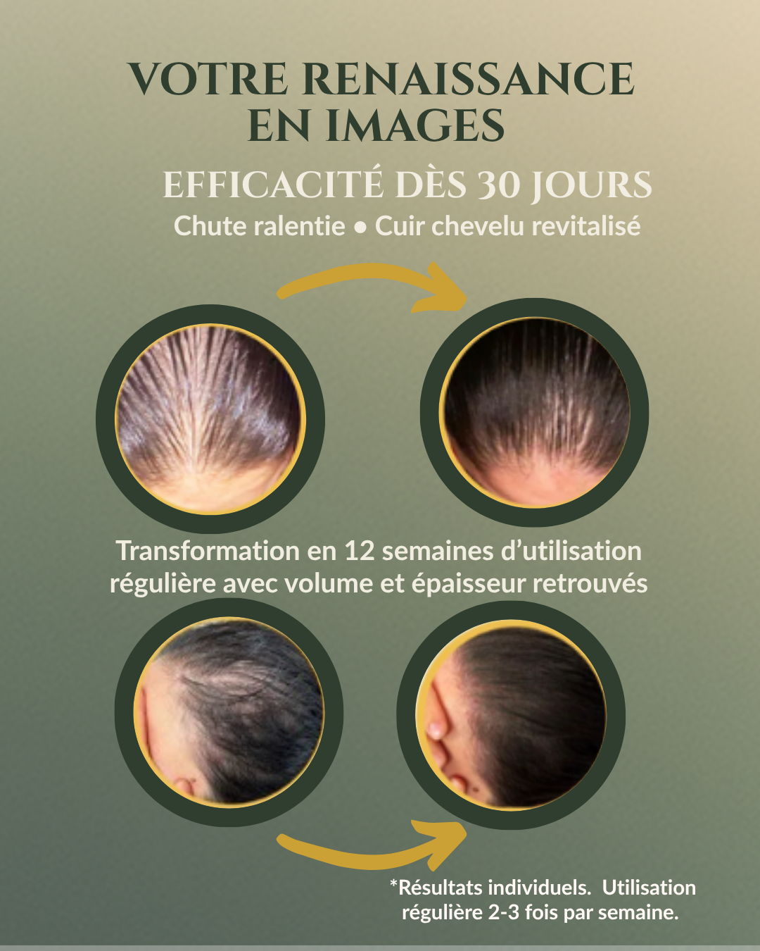 Botanical Growth Serum — the art of hair regeneration, powered by nature and backed by science