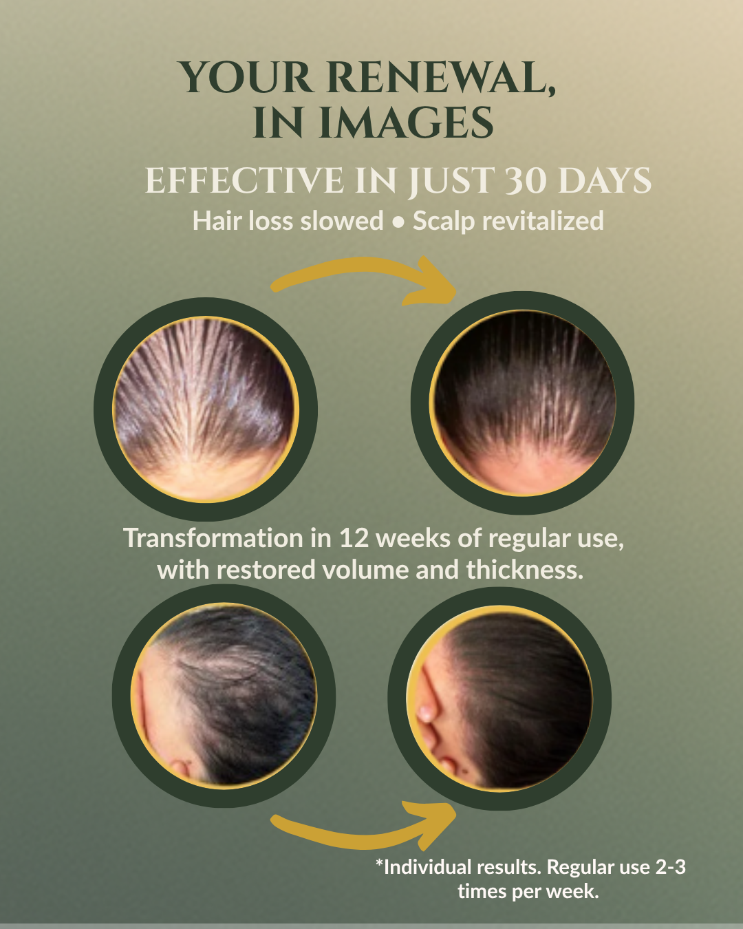 Botanical Growth Serum — the art of hair regeneration, powered by nature and backed by science